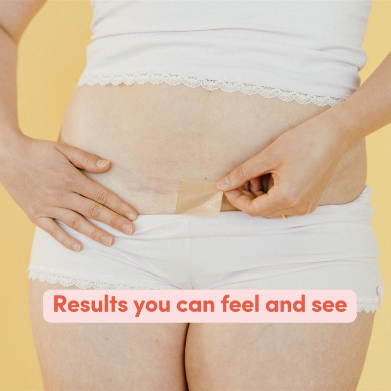 Female wearing white underwear applying a c-section scar patch with text overlay saying 'Results you can feel and see' on a yellow background